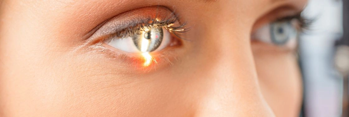 A szem fénytörési hibái